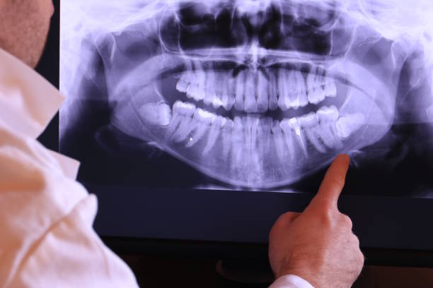 Best Weekend Emergency Dental Services in Nebo, NC