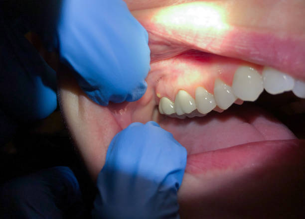 Best Emergency Orthodontic Repairs in Nebo, NC